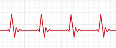 Basic ECG Training